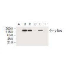 Anti-Phospho-HER2 / ErbB2 (Thr 686) antibody [4G3]