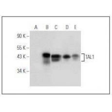 Anti-TAL1 / SCL LS-C182473 antibody [4G1]