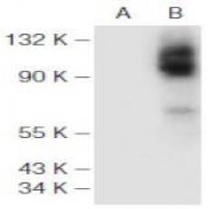 Anti-HIF-1 alpha antibody [5H7]