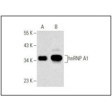 Anti-TNFR1 antibody [2G2]