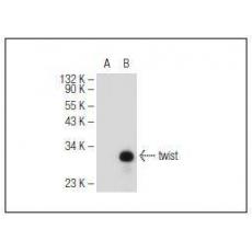 Anti-Twist antibody [1G3]