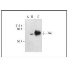 Anti-YAP1 antibody [3G1]