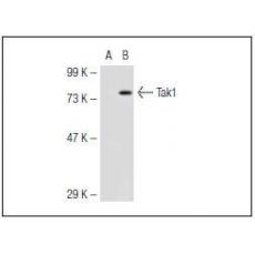 Anti-MAP3K7 antibody [1G5]