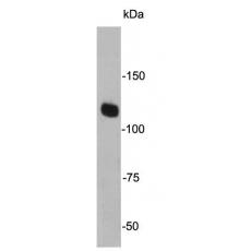 Anti-JAK2 antibody [6-D3]