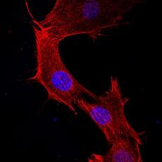 Anti-Beta actin antibody [A2-F6]