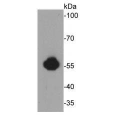 Anti-ALDH2 antibody [E4-D10]