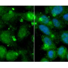 Anti-AK6 antibody [B1-F4]