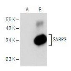 Anti-SFRP1 antibody [4G04]