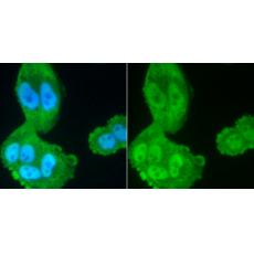 Anti-PP2A(alpha+beta) antibody [A0-G7]