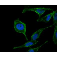 Anti-Atg12 antibody [1-11]
