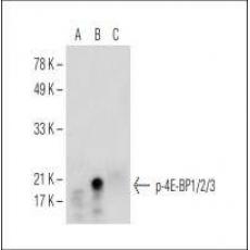 Anti-Phospho-4E-BP1/2/3 (Thr 45) antibody [3G2]