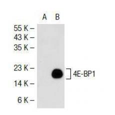 Anti-4E-BP1 antibody [3G1]