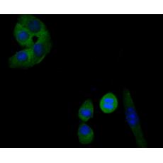 Anti-Transferrin antibody [E4-E6]