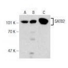 Anti-SATB2 antibody [4G03]