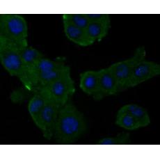 Anti-Alpha-2-macroglobulin antibody [8-B10]