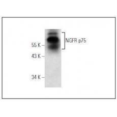 Anti-NGF Recepr antibody [2G2]