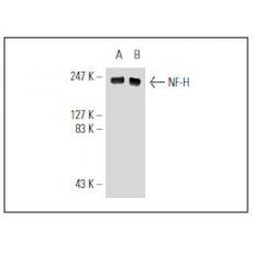 Anti-NF-H antibody [2G1]