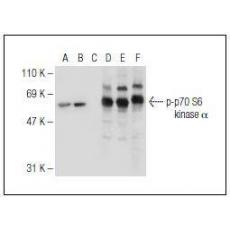 Anti-Phospho-p70 S6 Kinase (Ser 411) antibody [2G1]