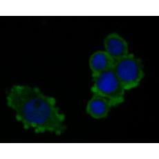 Anti-LAMP2 antibody [D3-D8-D3]