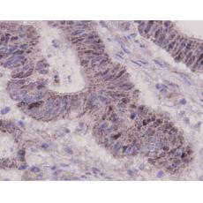 Anti-p53 antibody [7-5]