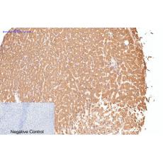 Anti-CD16 antibody [Q32]