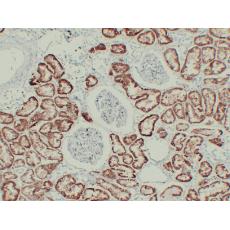 Anti-pVHL antibody [PT0230]