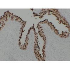 Anti-Uroplakin III antibody