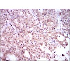 Anti-SRY antibody [E9-G4]