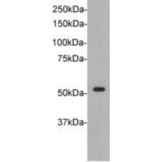 Anti-TdT antibody [B4-F5]