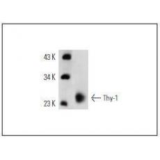 Anti-Thy-1 (OX7) antibody [1G2]