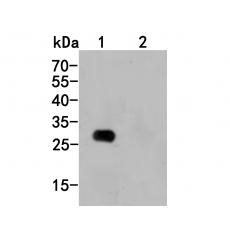 Anti-6X His tag (C terminal) antibody [8-F0]