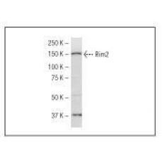 Anti-RIM 2 antibody [3G2]
