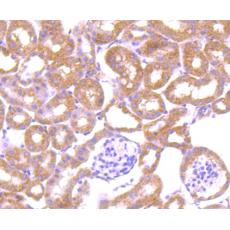 Anti-LRRK1 antibody [5B1]