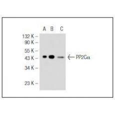 Anti-PP2C alpha antibody [3G1]