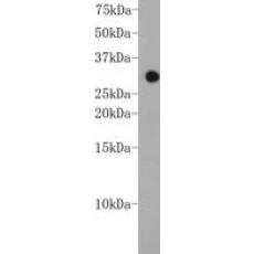 Anti-CHD1 antibody [2-2]