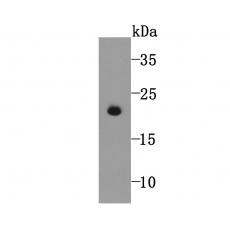 Anti-GPX5 antibody [5A1]