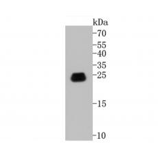 Anti-Caveolin-1 antibody [A3E4]