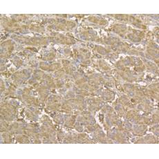 Anti-YKL-40 / CHI3L1 antibody [10C1]