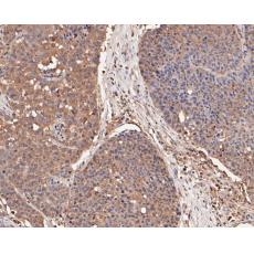 Anti-Caspr antibody [A2D3]
