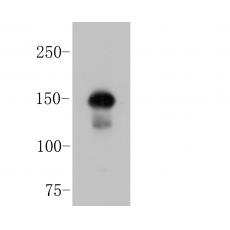 Anti-ROBO1 antibody [10E2]