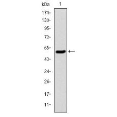 Anti-KID antibody [D1-E3]