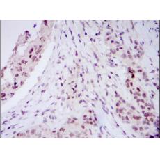 Anti-NACC1 antibody [D1-H2]