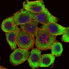 Anti-PINCH antibody [B9-G7]