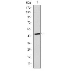 Anti-ApoB antibody [B1-G6]