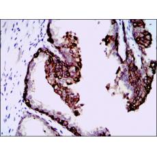 Anti-HAS3 antibody [B2-C9]