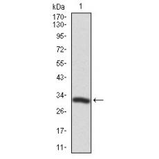 Anti-TWF1 antibody [A2-C11]