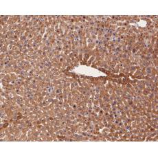 Anti-Glutamine Synthetase antibody [A3G2]