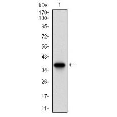 Anti-BRCA1 antibody [D2-C6]