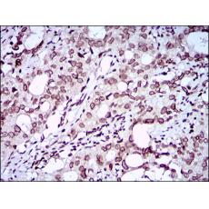 Anti-ZEB1 antibody [A2-D8]
