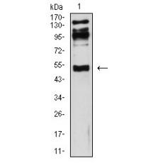 Anti-CD119 antibody [3E1A9]